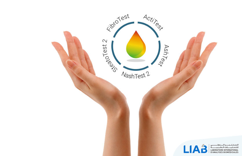 Nash-fibrotest - laboratoire international d'analyse biomedicale Casablanca