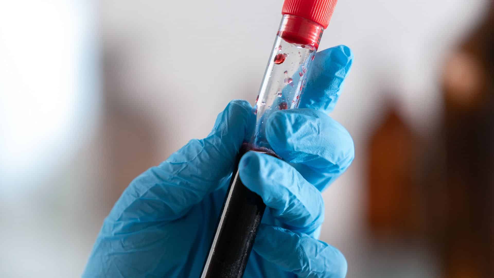 laboratoire d’analyses médicales à Casablanca | LIAB