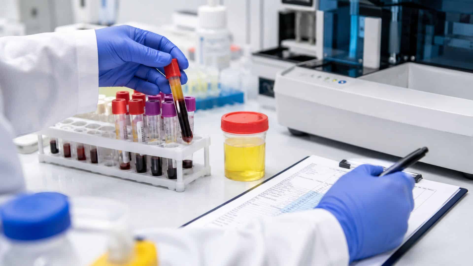 analyses biochimiques Casablanca | LIAB