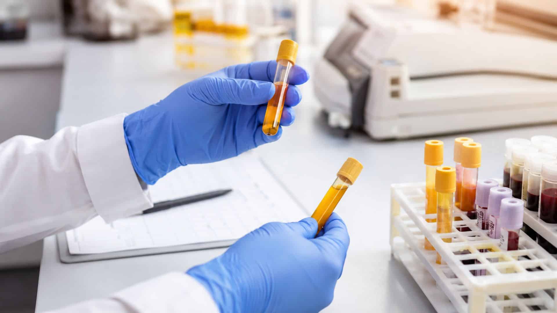 Analyses biochimiques Casablanca : le LIAB réalise vos bilans biologiques pour explorer le métabolisme et accompagner votre suivi médical.