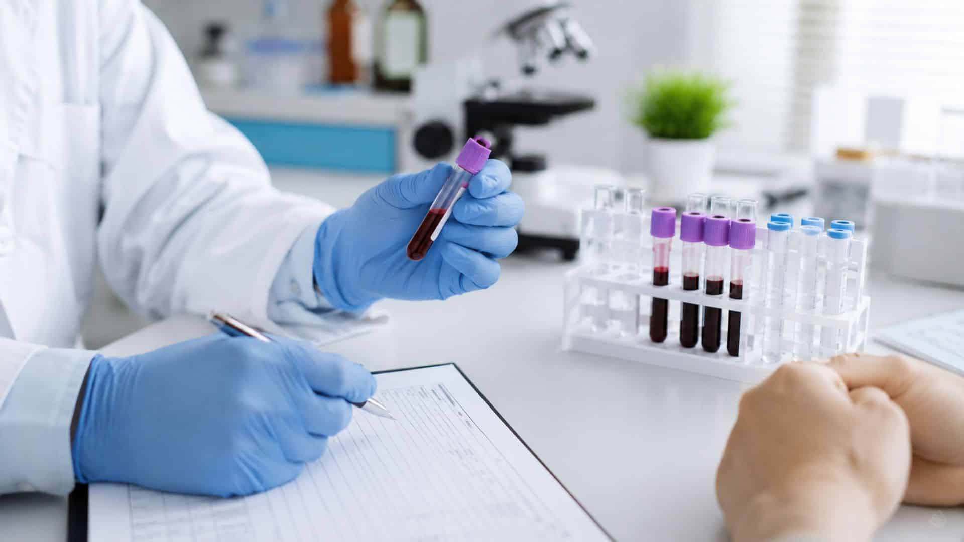 analyses biochimiques Casablanca | LIAB