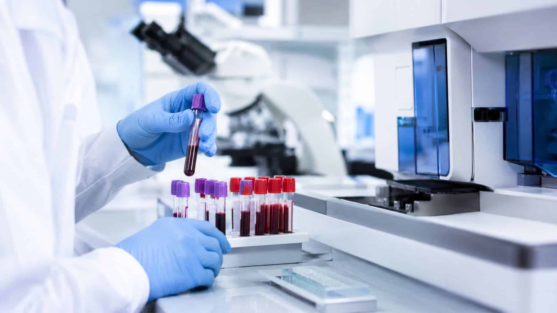 analyses hématologiques Casablanca | LIAB