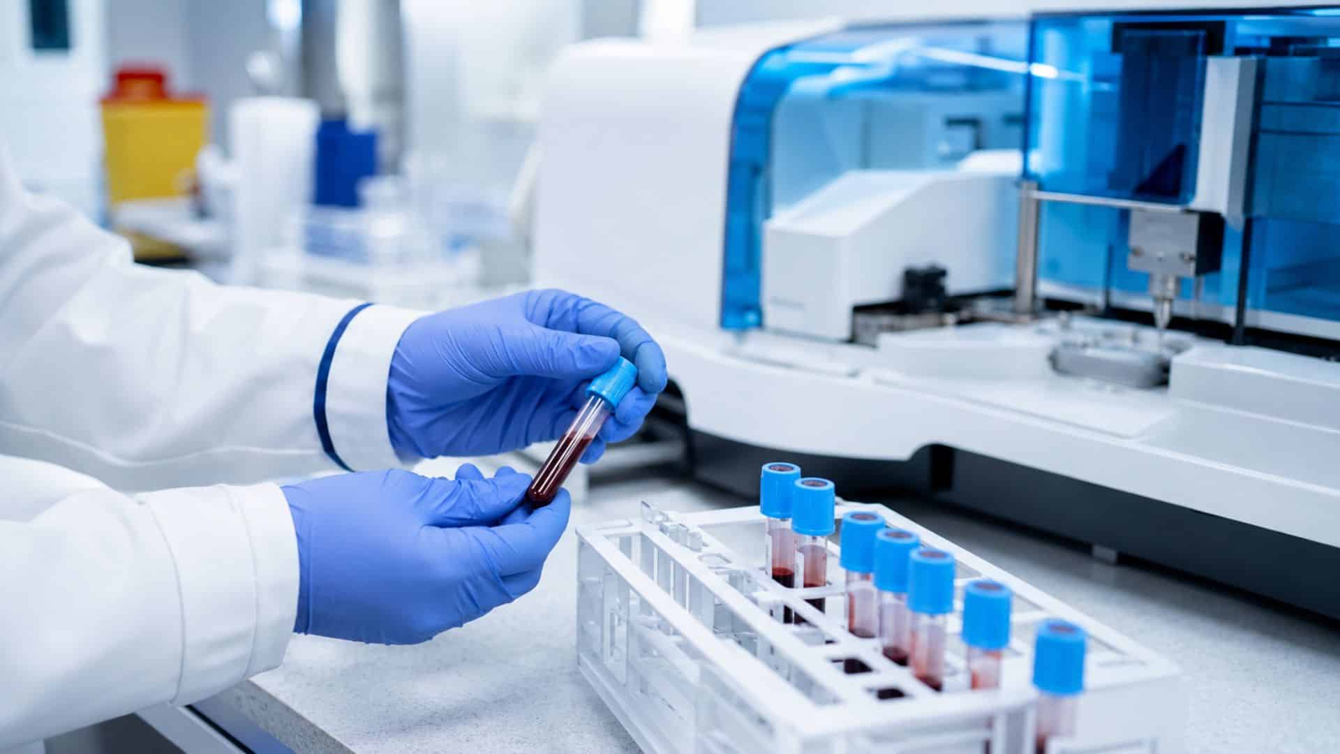 analyses hématologiques Casablanca | LIAB
