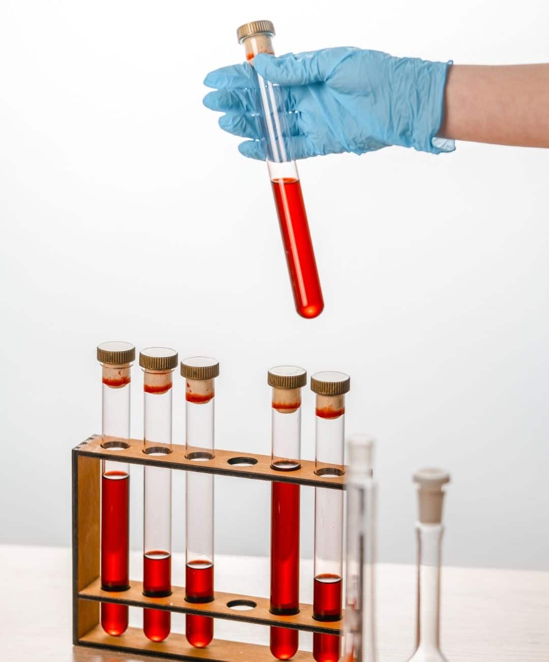 analyses hématologiques Casablanca | LIAB