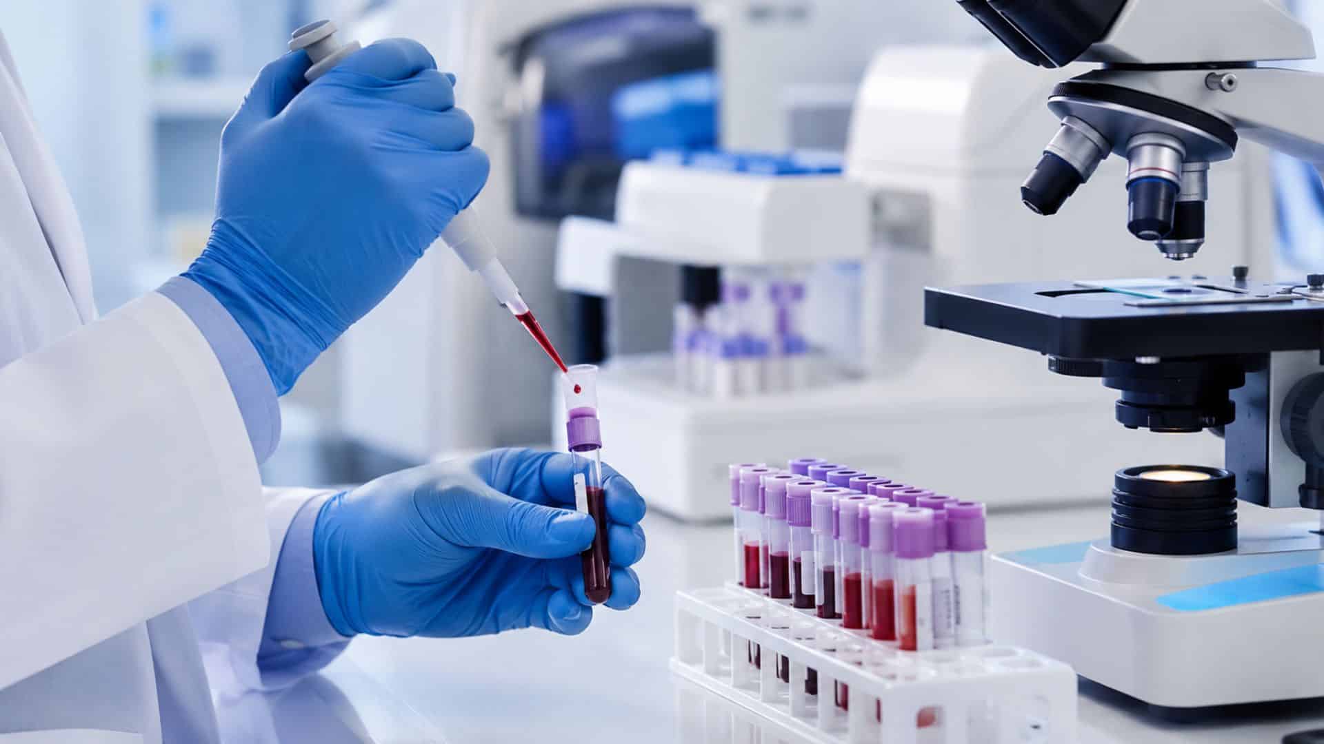 analyses immunologiques Casablanca | LIAB
