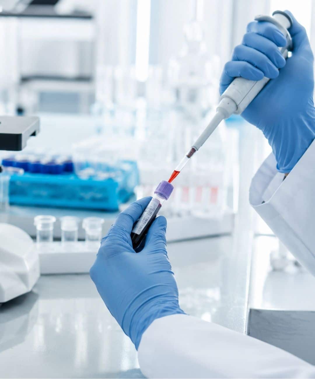 analyses immunologiques Casablanca | LIAB