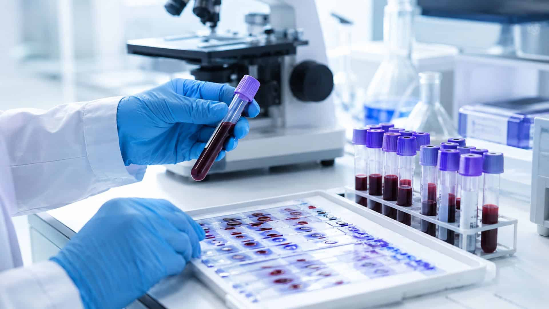 Dépistage infections Casablanca : le LIAB recherche différents agents infectieux grâce à des analyses adaptées au contexte clinique et à la prescription.