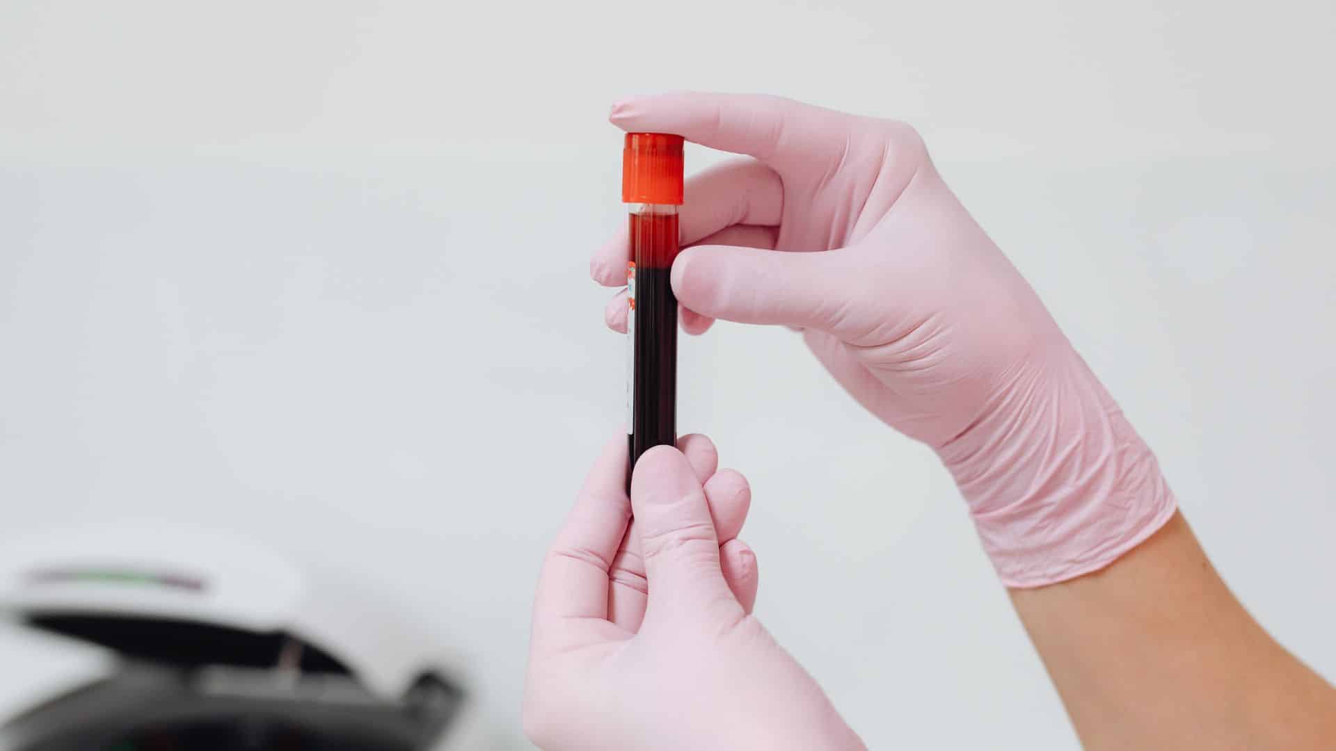 Sérologie Casablanca : le LIAB recherche des anticorps ou des antigènes pour contribuer au dépistage et au suivi de différentes infections.