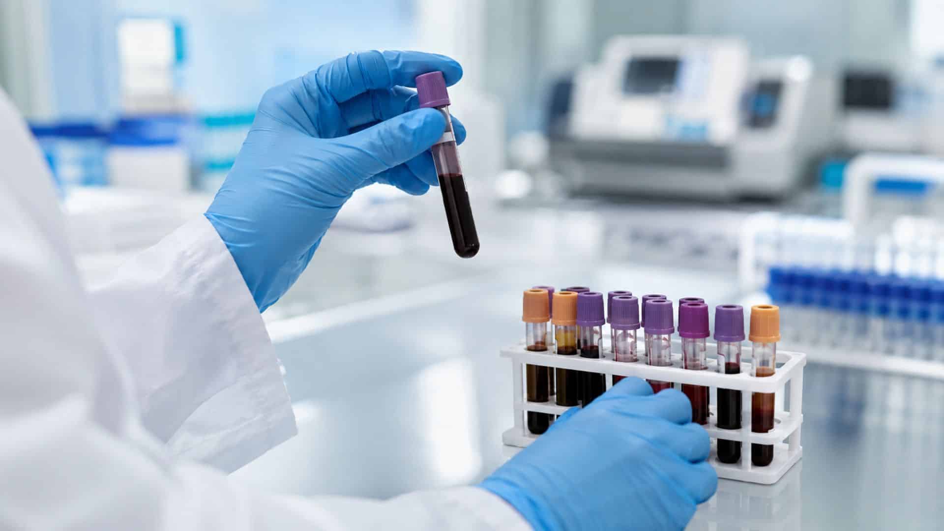sérologie Casablanca | LIAB