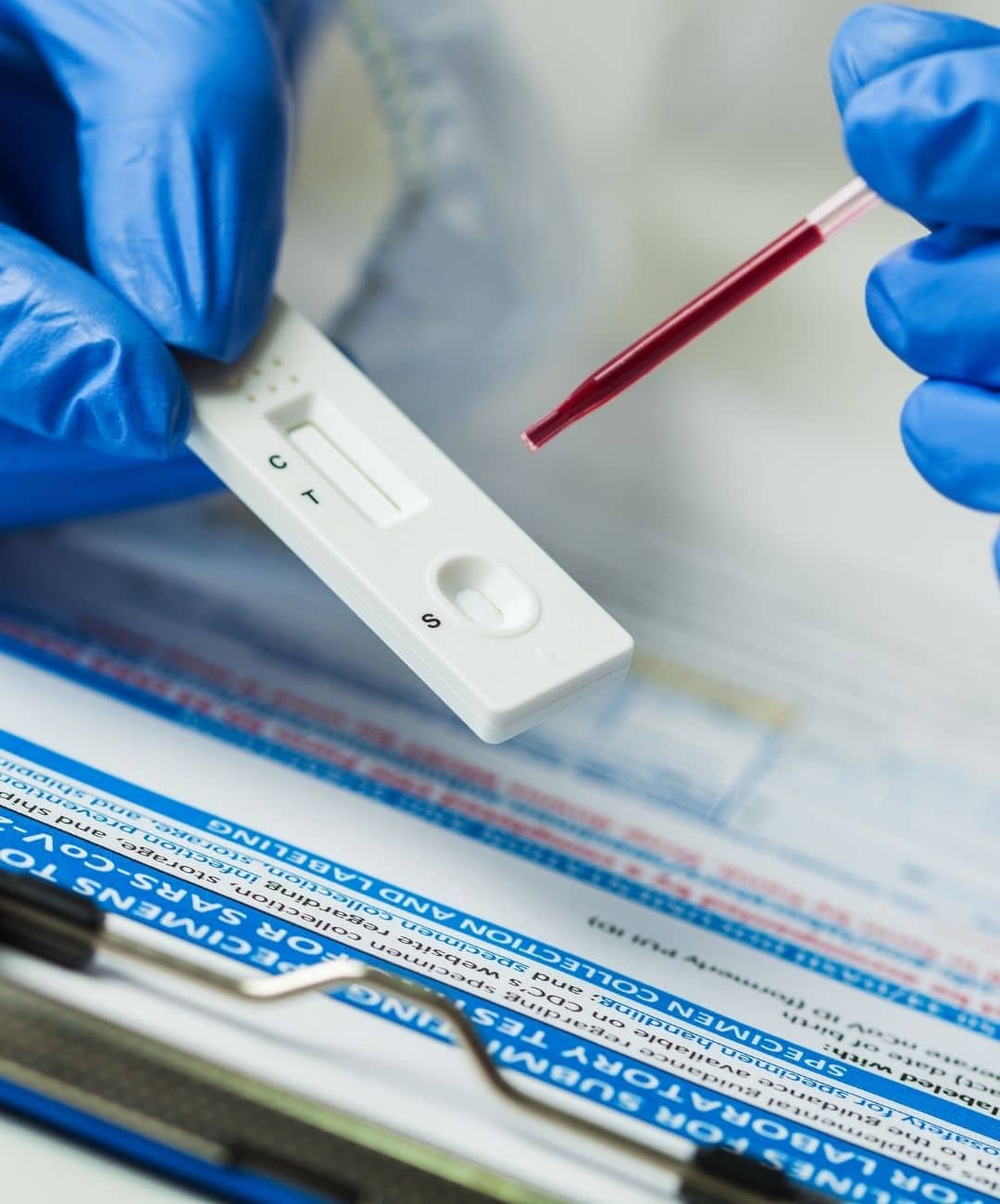 sérologie Casablanca | LIAB