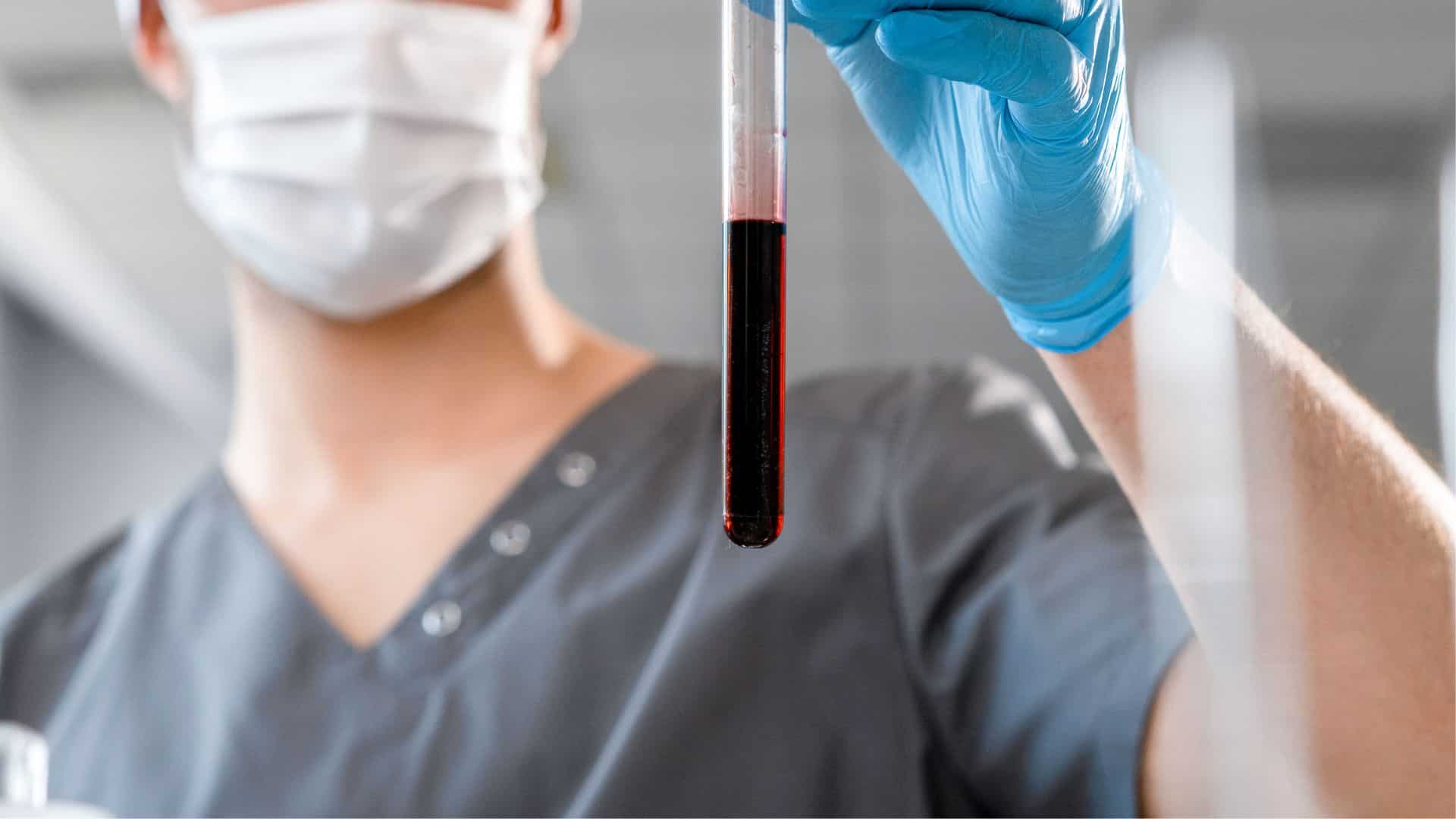 analyses hématologiques Casablanca | LIAB